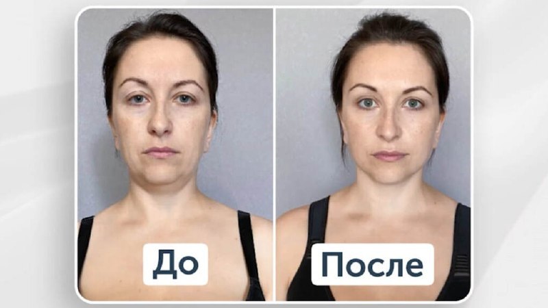 Ревиботик